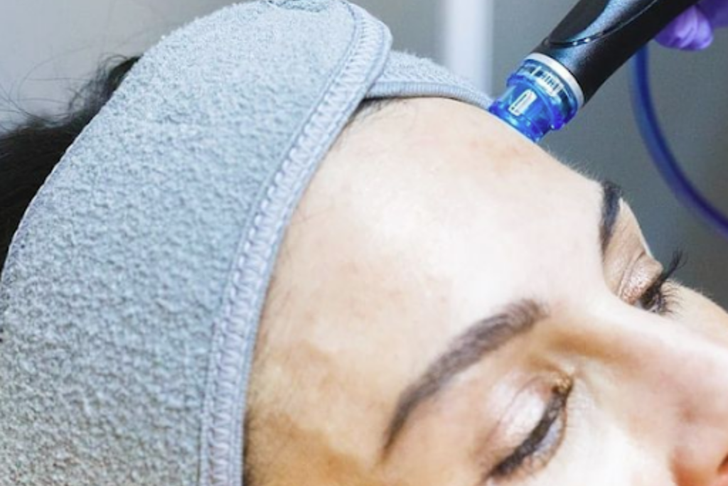 Hydrafacial: The Best Facial Treatment for Glowing Skin