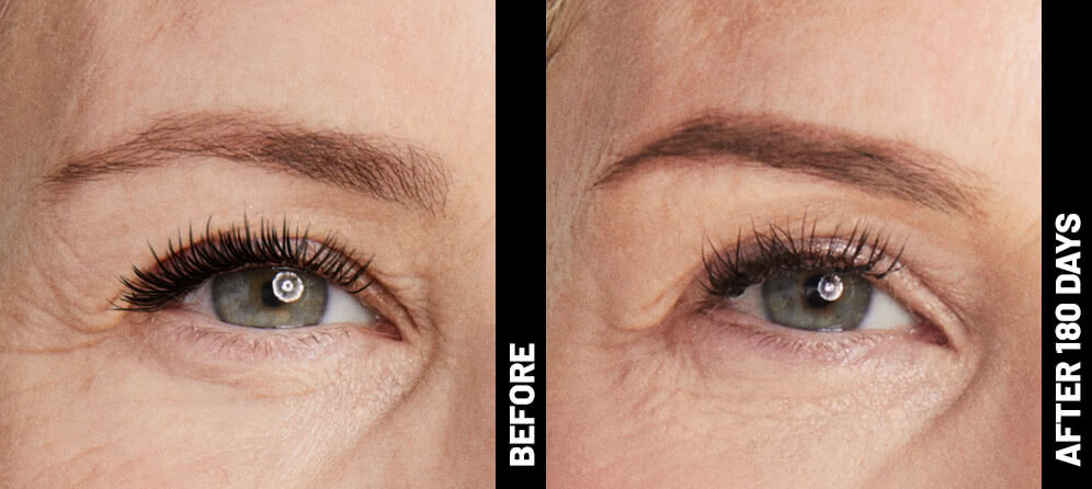 blinder-debbie-brow-after-180