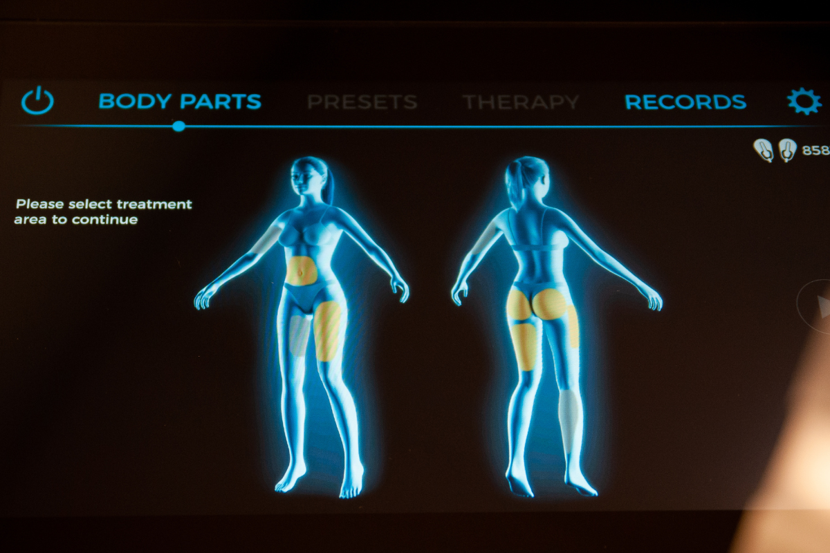 Emsculpt (2)